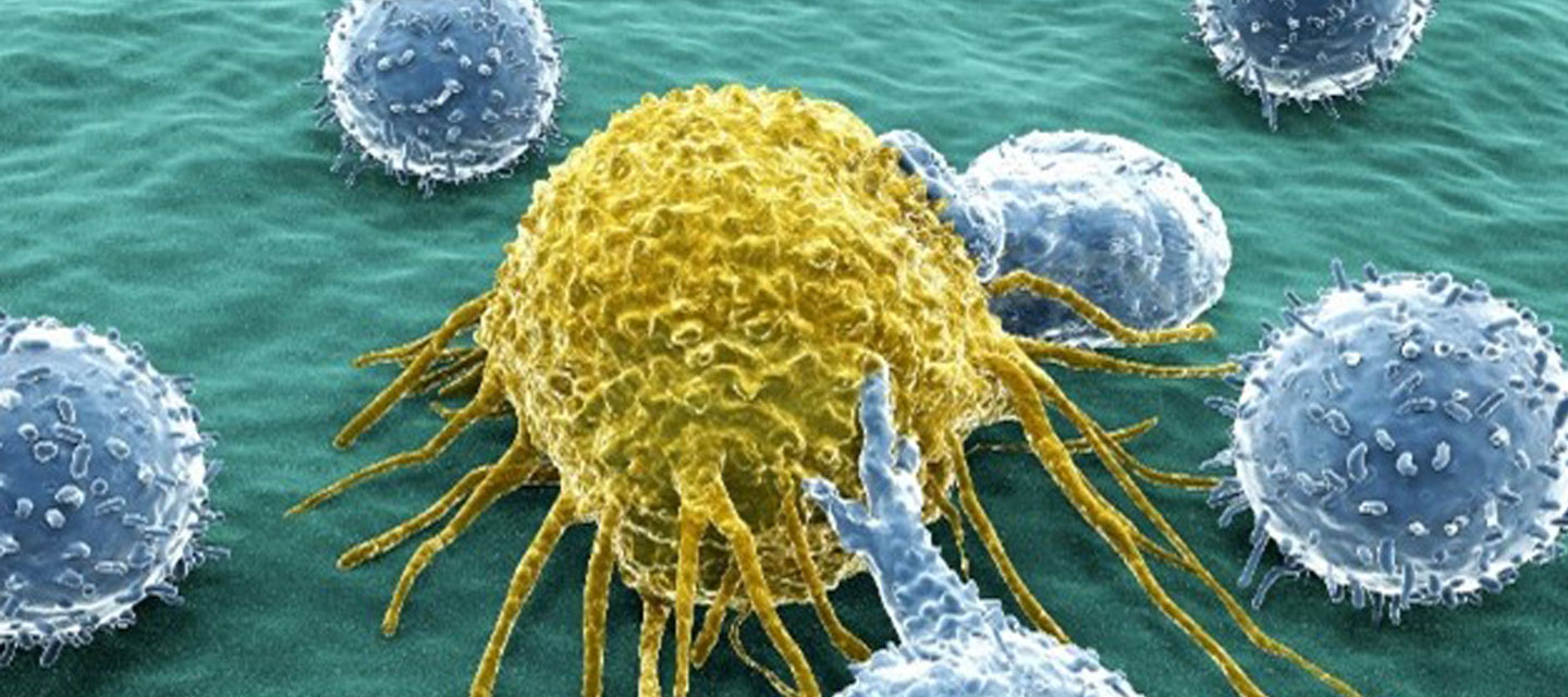 Bild zu Krebserkrankungen: Zehn blaue Immunzellen greifen eine gelbe Krebszelle an, auf grünem Hintergrund.