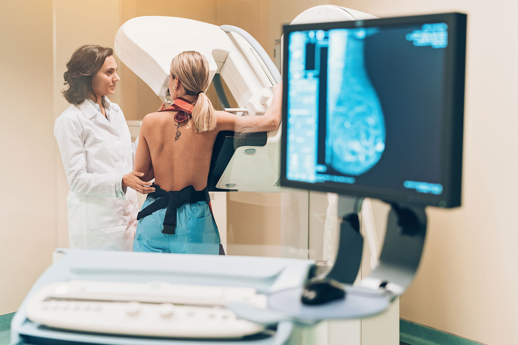 Brustkrebs: Eine Patientin bei der Mammographie