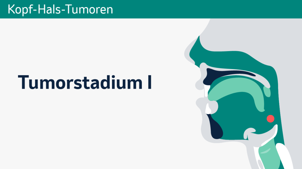 Kopf-Hals-Krebs, Tumorstadium I