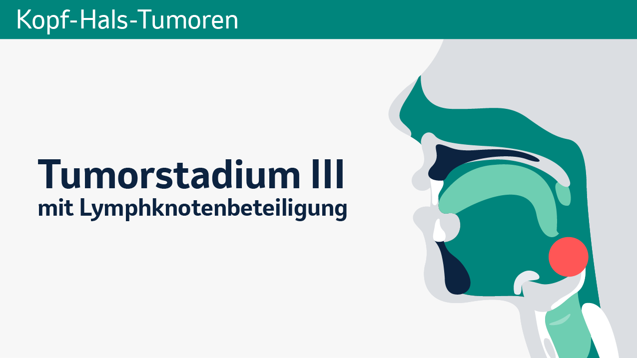 Kopf-Hals-Krebs, Tumorstadium III