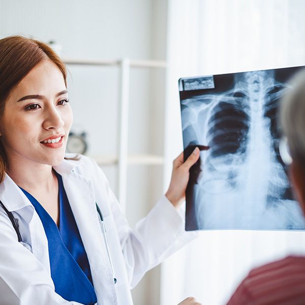 Zu sehen ist eine junge Ärztin, die das Röntgenbild einer Lunge gegen das Licht hält und im Austausch mit einer weiblichen Patientin ist.