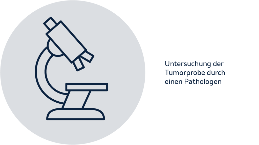 Untersuchung der Tumorprobe durch einen Pathologen