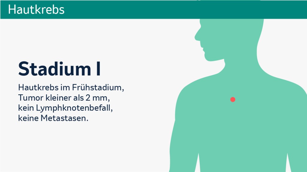 Melanom: Stadium I