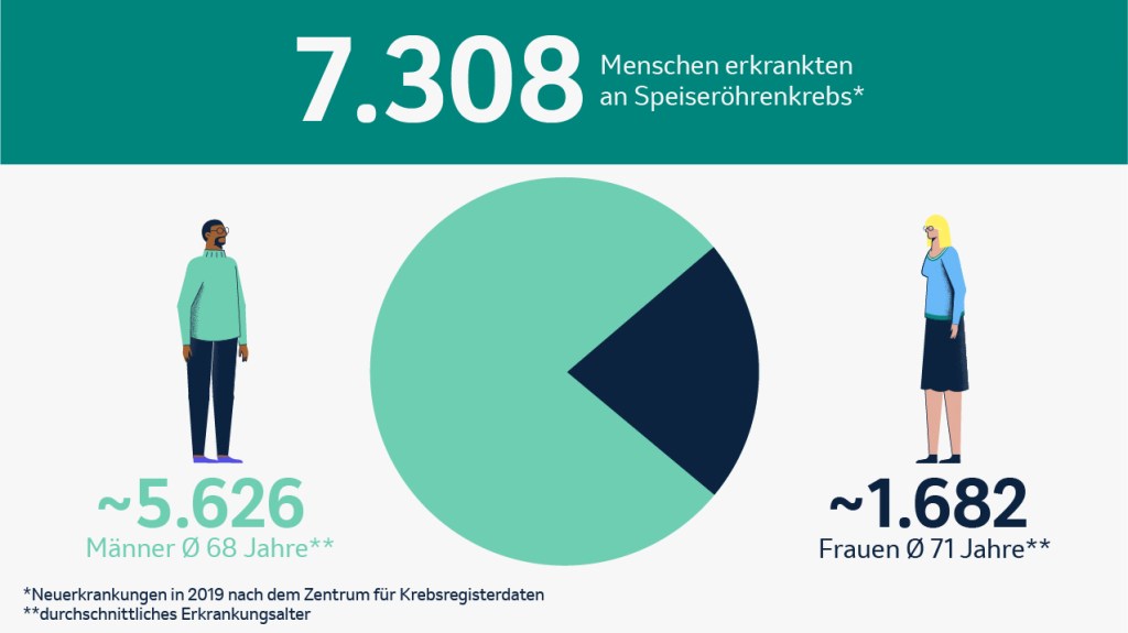 Statistik der Neuerkrankungen an Speiseröhrenkrebs in Deutschland im Jahr 2019.
