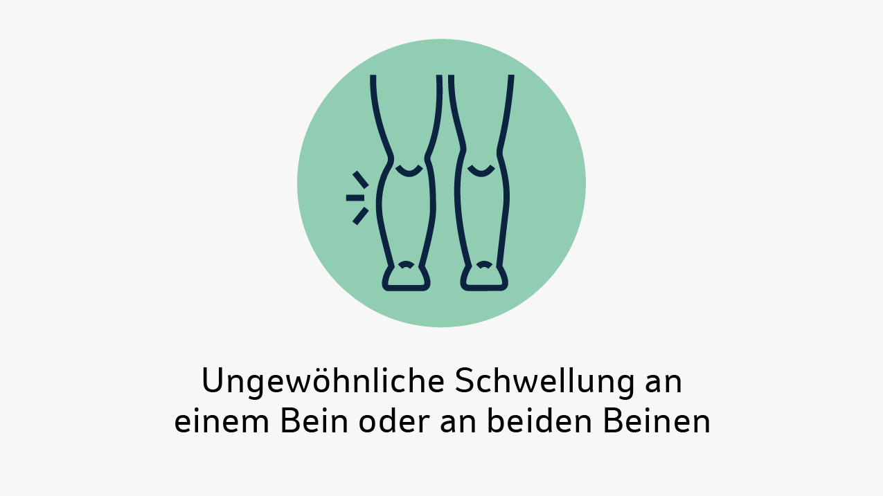 Symbol zweier Beine, eines mit Markierung, als Hinweis auf ungewöhnliche Schwellung.