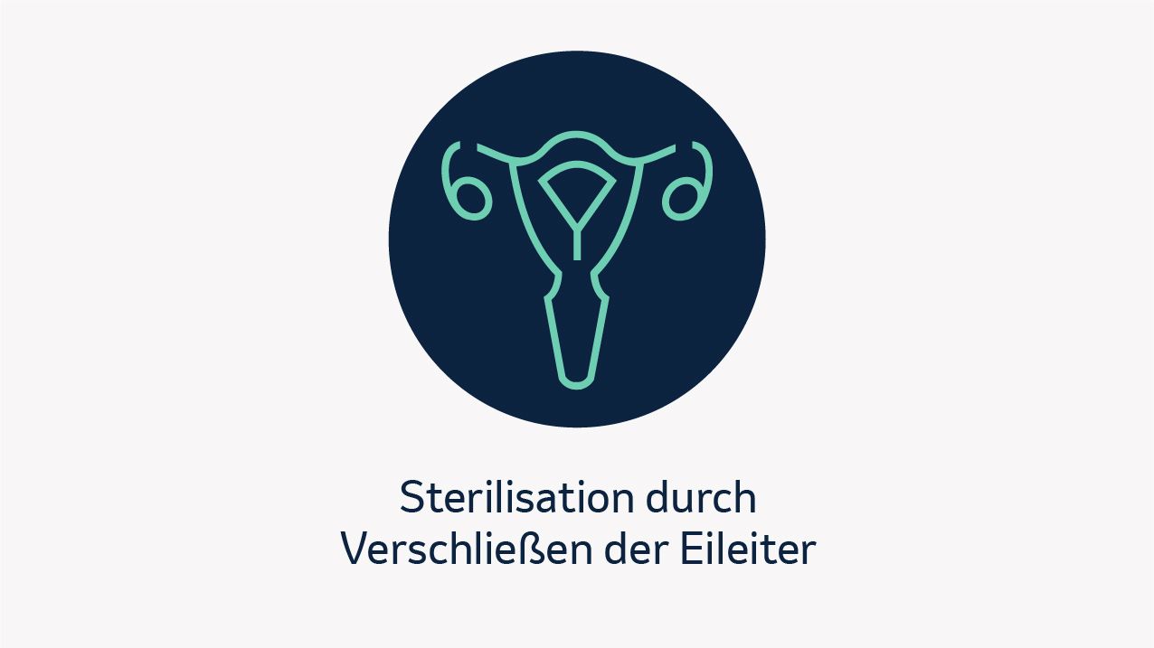 Sterilisation durch Verschließen der Eileiter