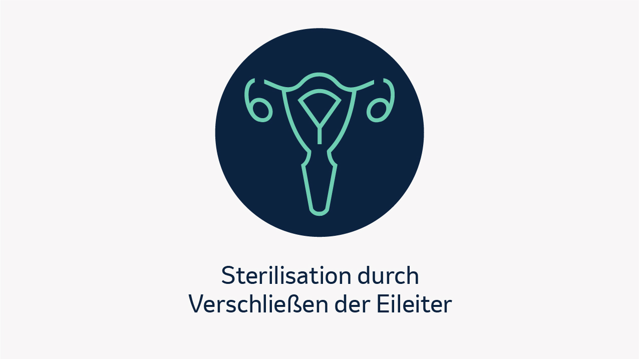 Sterilisation durch Verschließen der Eileiter
